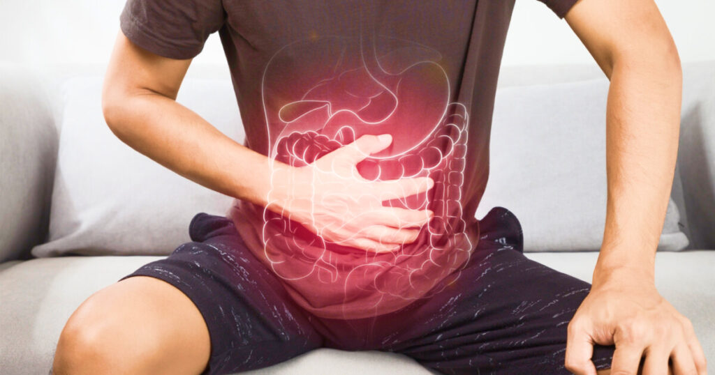 Common Digestive Conditions