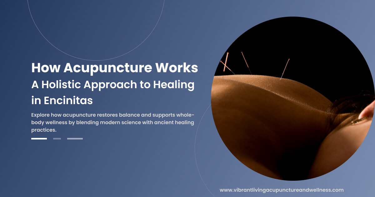 How Acupuncture Works: A Holistic Approach to Healing in Encinitas