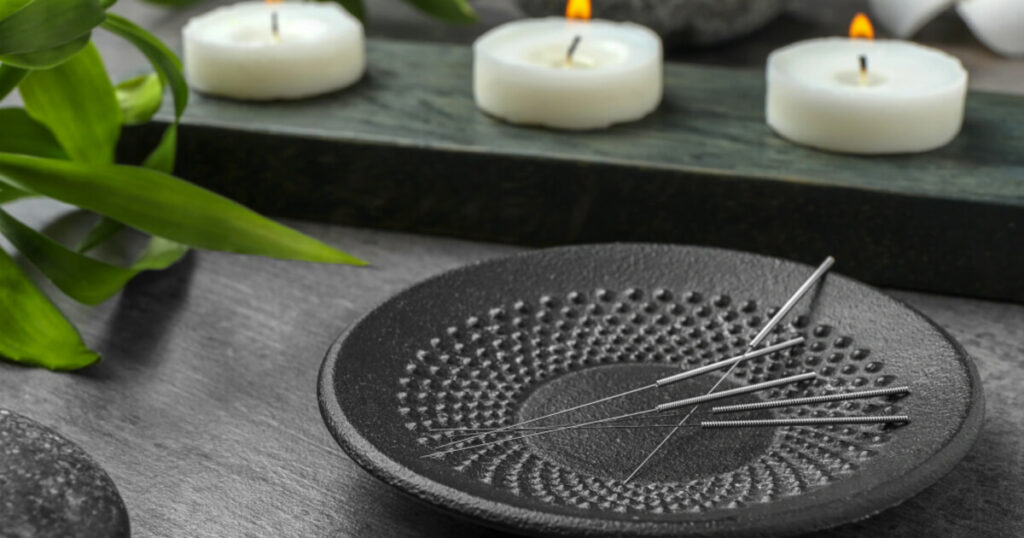 What to Expect During an Acupuncture Session?