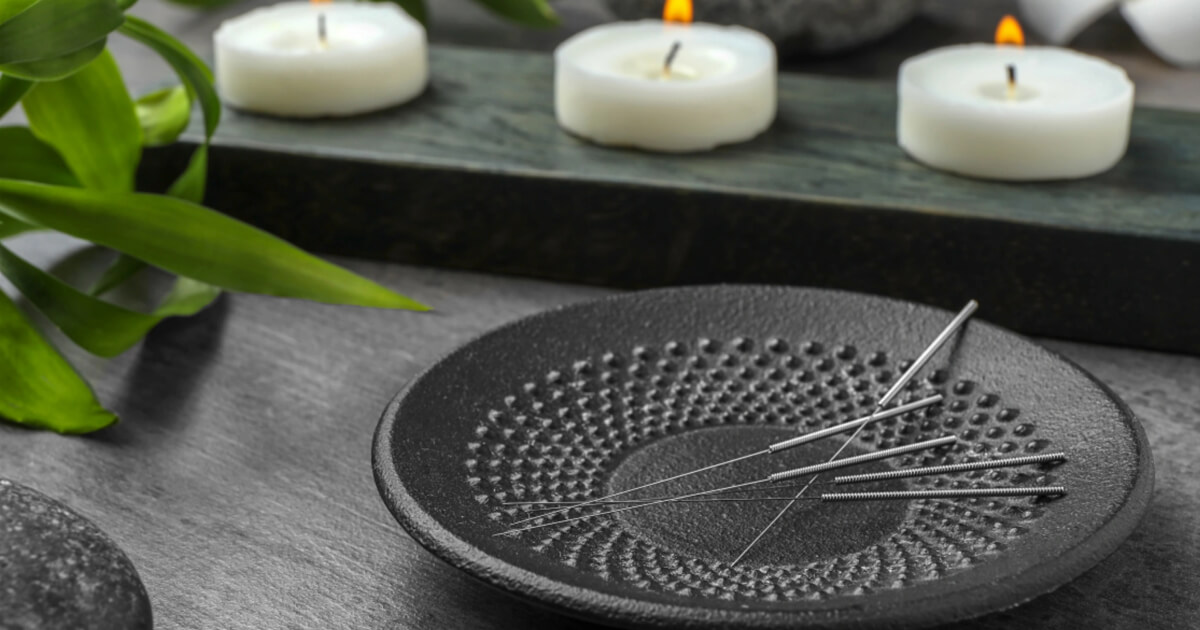 What to Expect During an Acupuncture Session?